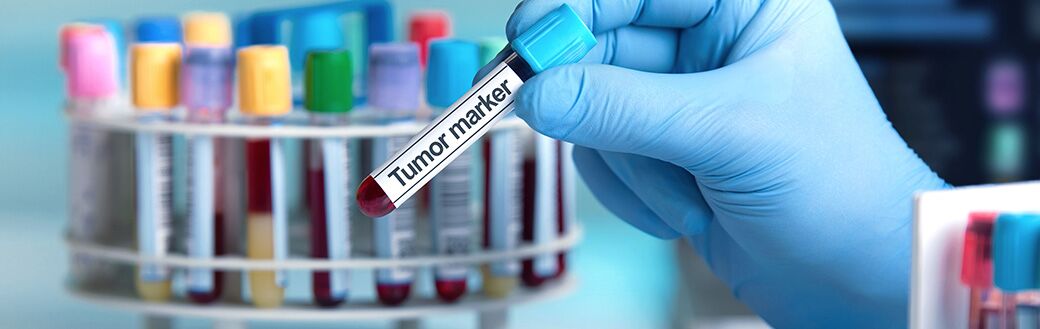 tumormarker